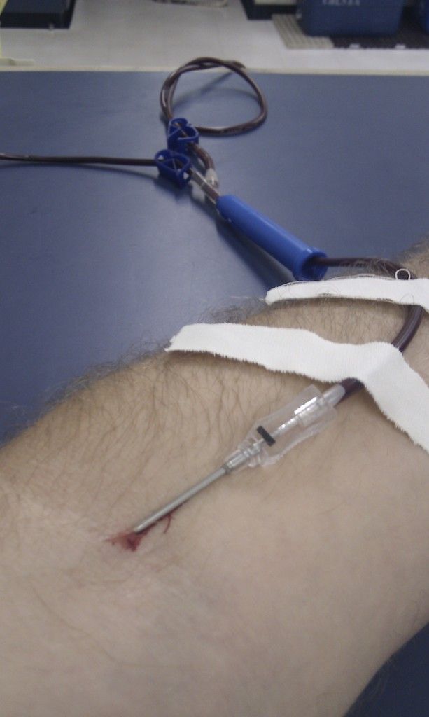 Scientists Employing Magnetism for Physician-Assisted Body Recovery