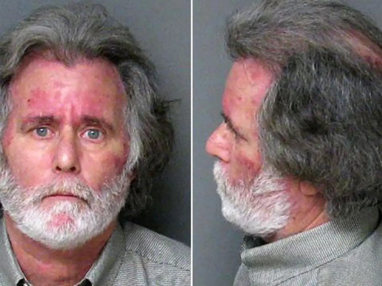 Struggles with Triumph: Unveiling the Reasons Behind Self-Imposed Hindrances on Achievement Goals