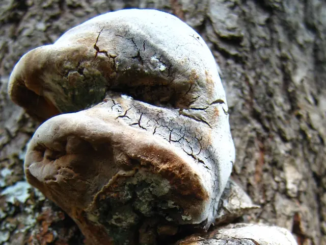 Nocardiosis in the Lungs: A Comprehension of the Disease