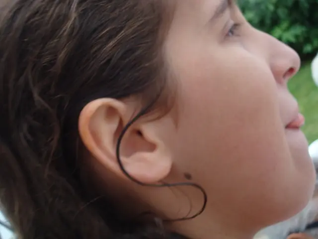 New Mole Development: Reasons and Potential Red Flags