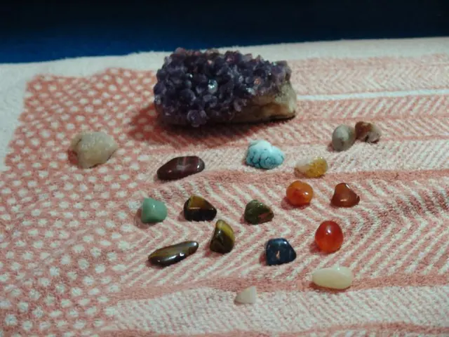 Stone located within the navel, explaining factors leading to its formation, associated symptoms,...