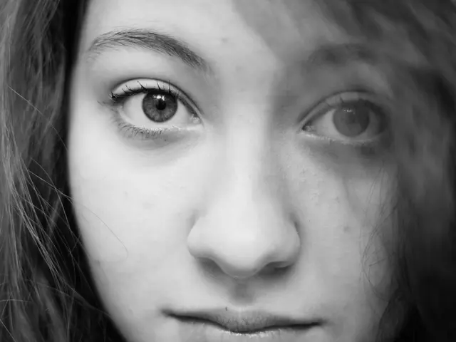 Methods and Solutions for Eliminating Blackheads: Advice and Suggestions