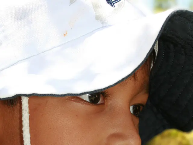 Treatment options for adolescent acne: Prescription drugs and home solutions