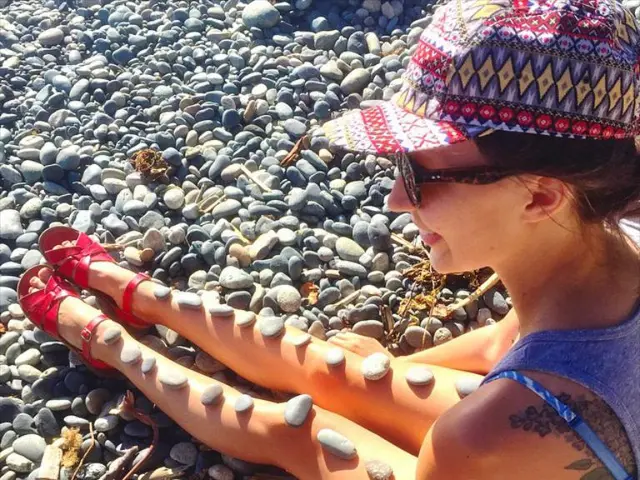 Rapid Increase in Kidney Stones Among the Youth: Unveiling the Secret Factors