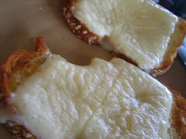 Liposuction for Cellulite Removal Explored