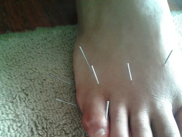 X-ray examination of the pelvis: Method, risks, and further details