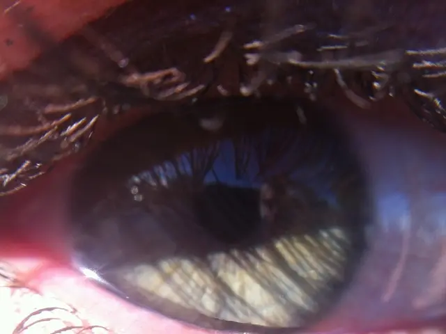 Castor Oil for Longer, Thicker Eyelashes: Application Guide and Safety Considerations